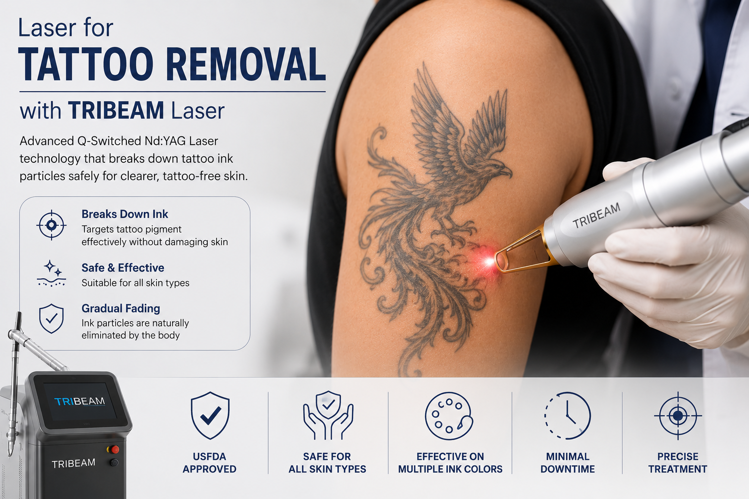 Laser Tattoo Removal